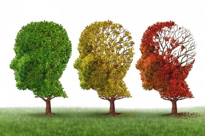 “Alzheimer Hastalığını Geri Döndürmek Mümkün Değil Ama Yavaşlatmak Elimizde”